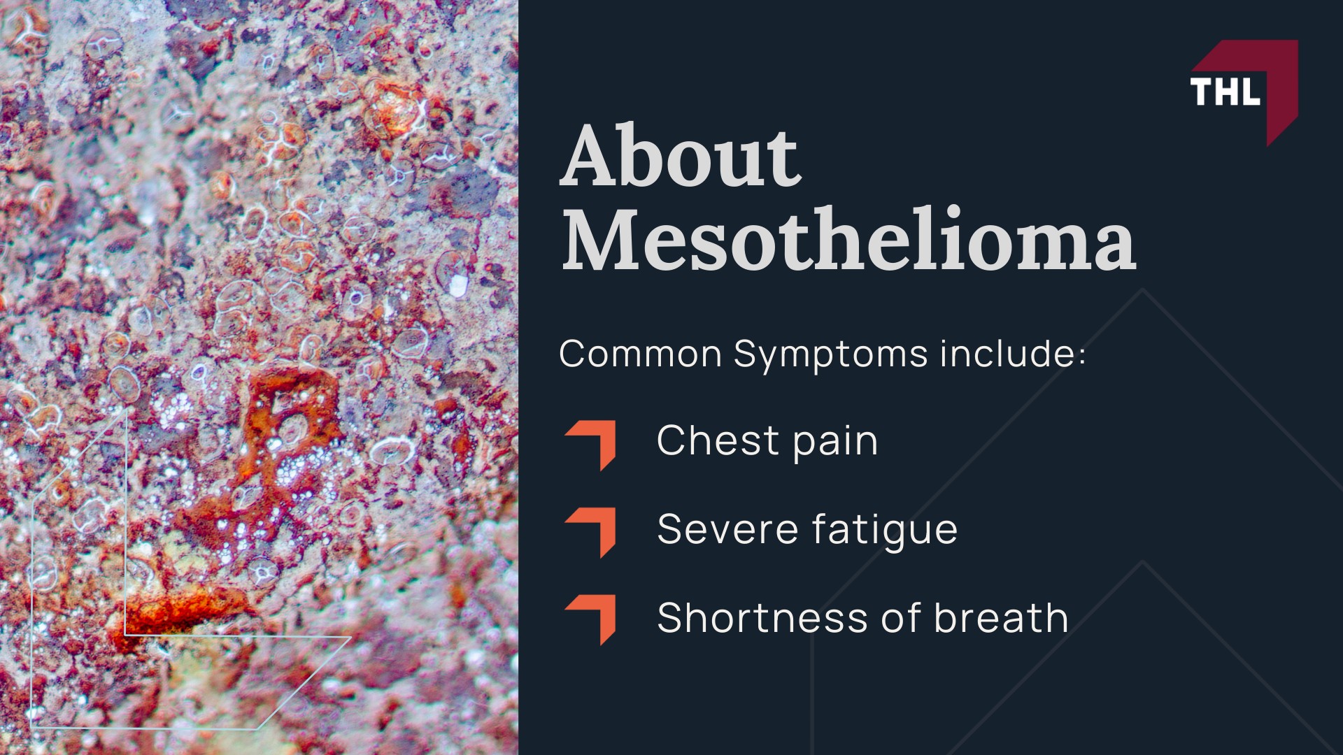 About Mesothelioma