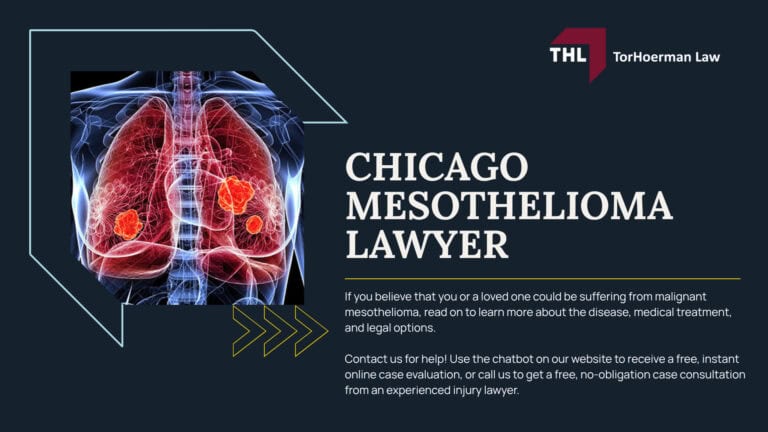 What Causes Mesothelioma; Mesothelioma & Exposure to Asbestos; What is Asbestos; Where Can You Be Exposed to Asbestos in Chicago; How Does Asbestos Cause Cancer; What are the Common Symptoms of Mesothelioma; Asbestos & Mesothelioma Statistics in Chicago; Chicago Workplace Asbestos Exposure; Asbestos Superfund Sites in Illinois; Illinois Cities with Known Asbestos Exposure; Chicago Mesothelioma Treatment Options; Filing a Chicago Mesothelioma Lawsuit; Hiring a Chicago Mesothelioma Lawyer; Before You File a Chicago Mesothelioma Lawsuit; Chicago Mesothelioma Lawyer