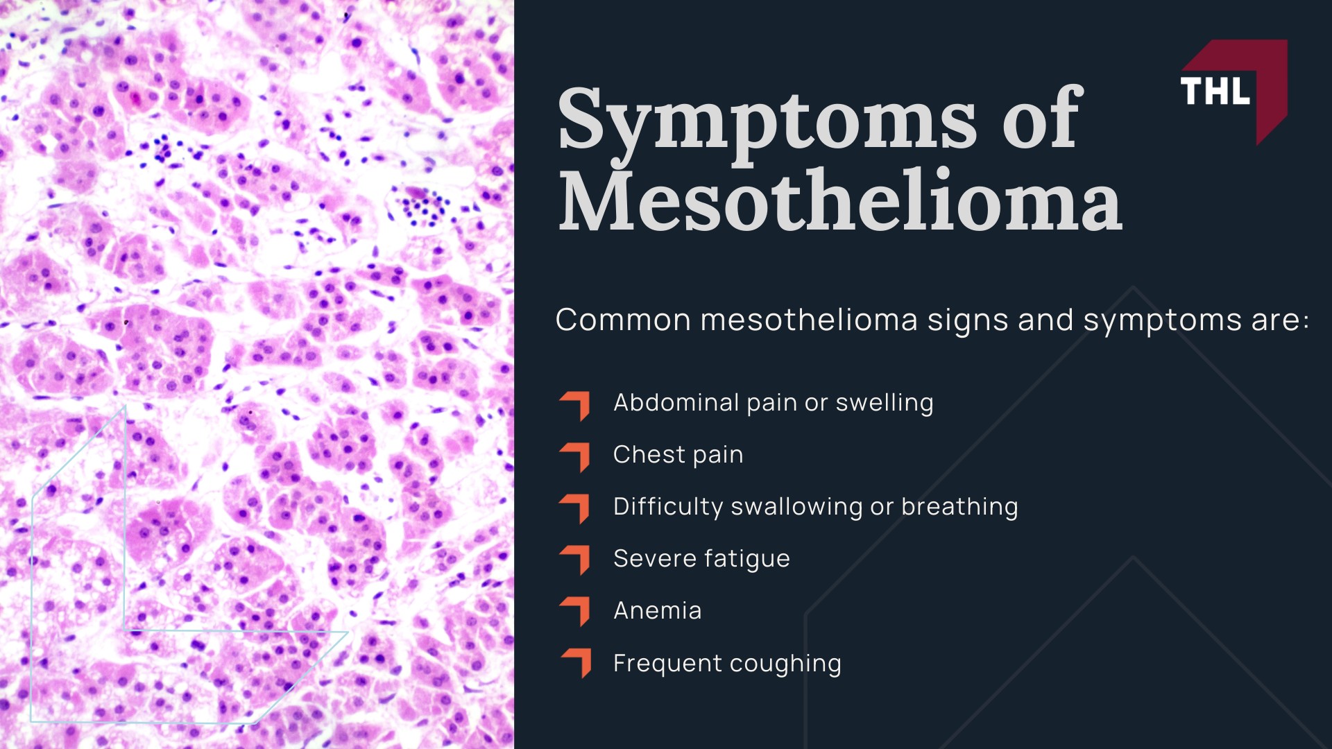 About Mesothelioma; Common Cause of Mesothelioma in St. Louis; Asbestos Exposure; What is Asbestos; Asbestos Exposure in St. Louis; How Does Asbestos Exposure Cause Mesothelioma; Symptoms of Mesothelioma