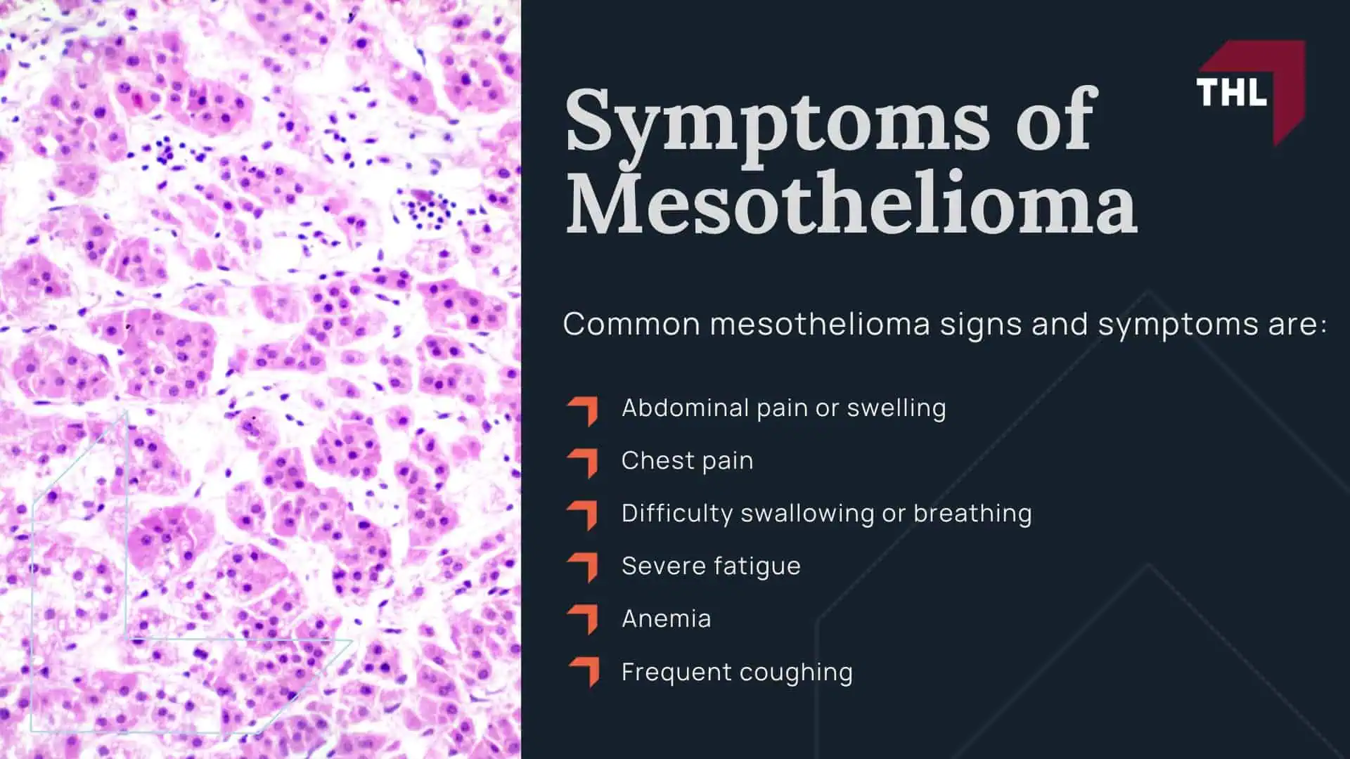 Symptoms of Mesothelioma