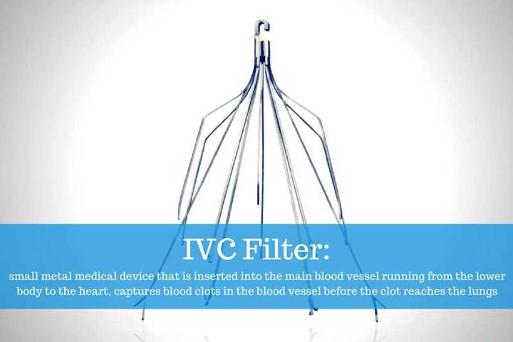ivc filters overused medical providers not always removed 720
