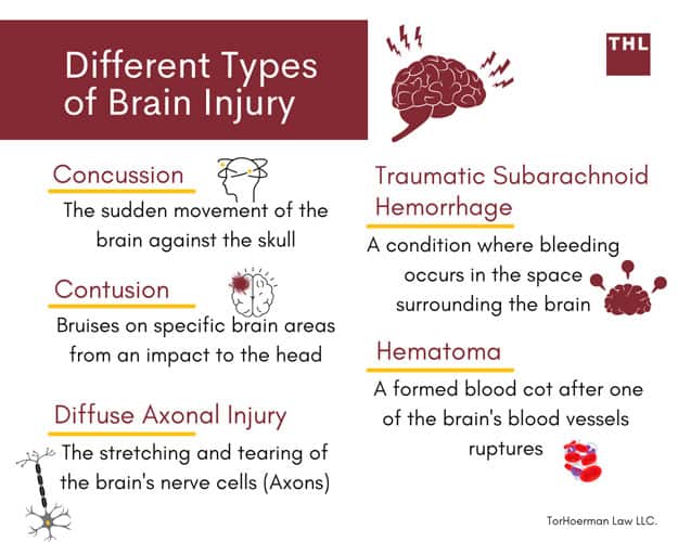 Brain injury; personal injury; types of brain injury; concussion; contusion; diffuse axonal injury; traumatic subarachnoid hemorrhage; hematoma
