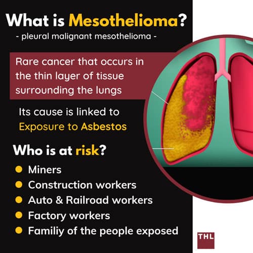 Mesothelioma; Mesothelioma cancer; Exposure to asbestos; Pleural Malignant Mesothelioma; asbestos linked to mesothelioma; lung cancer; injury lawyers; personal injury workplace attorney;