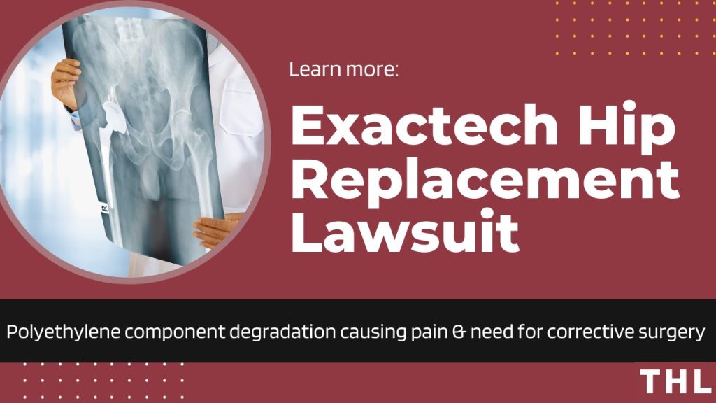 exactech hip, exactech hip lawsuit, exactech hip recall, exactech hip recall lawsuit, exactech hip injury, exactech hip replacement, exactech hip replacement lawsuit, exactech implant lawsuit, exactech hip liner, exactech hip replacement liner, exactech hip replacement liner recall, exactech liner recall, exactech polyethylene liner, exactech polyethylene liner degradation, exactech recall 2022; exactech hip, exactech hip lawsuit, exactech hip replacement, exactech hip replacement lawsuit, exactech hip implant, exactech hip implant lawsuit, polyethylene recall exactech, polyethylene degradation, exactech recall lawsuit, exactech recall, fda exactech recall, exactech hip recall, exactech implant recall, exactech hip implant recall, exactech liner recall, exactech hip liner, exactech liner, exactech hip replacement liner