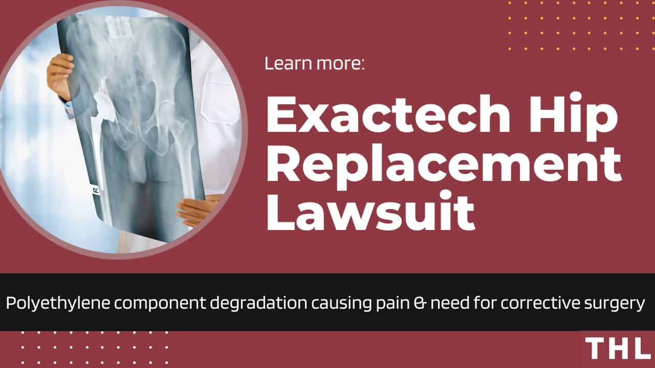 Exactech hip replacement lawsuit
