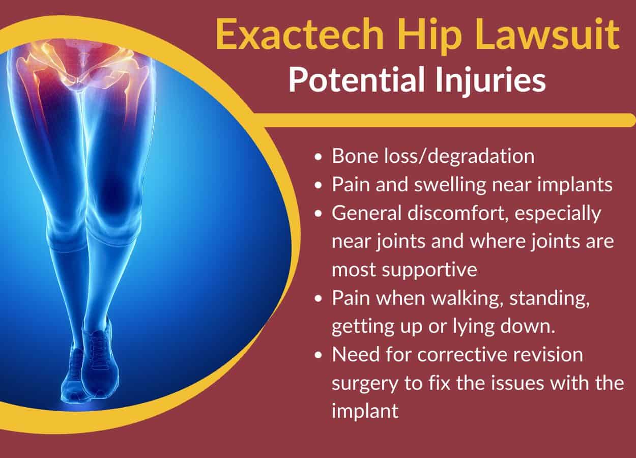 exactech hip replacement liner injuries