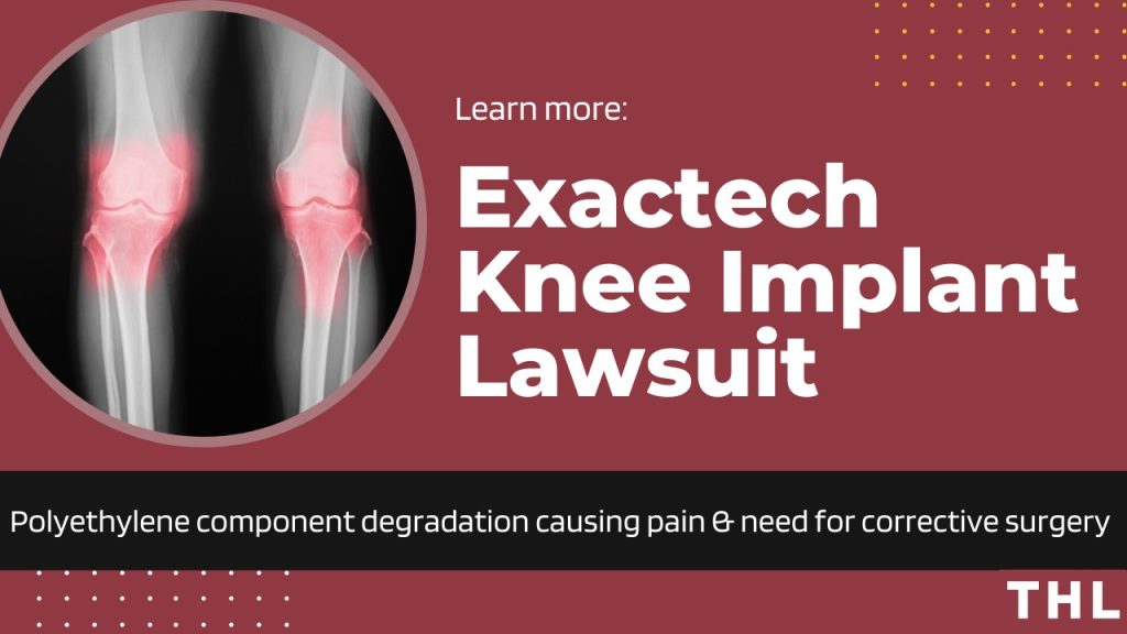 exactech knee lawsuit, exactech knee, exactech knee replacement, exactech knee replacement lawsuit, exactech knee implant, exactech recall, exactech knee recall, exactech knee replacement recall, exactech polyethylene, exactech polyethylene recall, exactech recall lawsuit, exactech ankle, exactech ankle recall, exactech ankle lawsuit; exactech knee lawsuit, exactech ankle lawsuit, exactech knee implant lawsuit, exactech knee replacement lawsuit, exactech knee and ankle lawsuit, exactech recall lawsuit, exactech recall, exactech knee implant recall, exactech knee implant recall lawsuit, exactech recall lawsuit 2022, exactech polyethylene recall, exactech polyethylene lawsuit, exactech polyethylene degradation, exactech knee replacement recall lawsuit