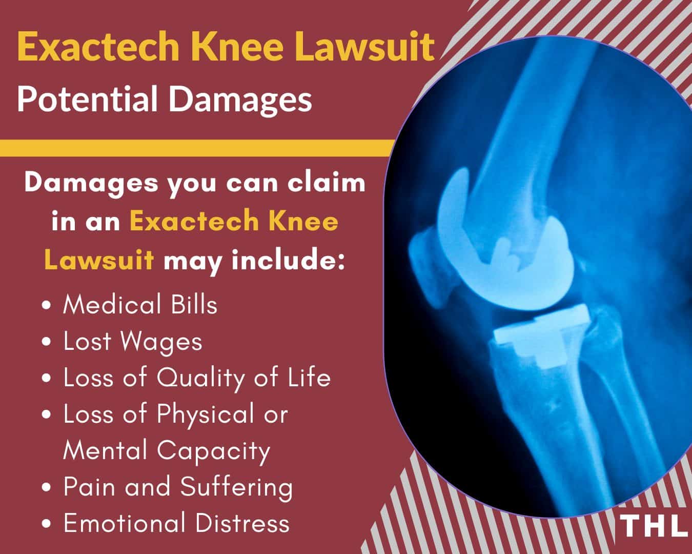 Assessing Damages Assessing Damages is something your lawyer will help you with. Damages are the total losses incurred as the result of an accident or injury that can be recouped with financial compensation. Damages can include medical bills, lost wages, permanent health effects, and more.