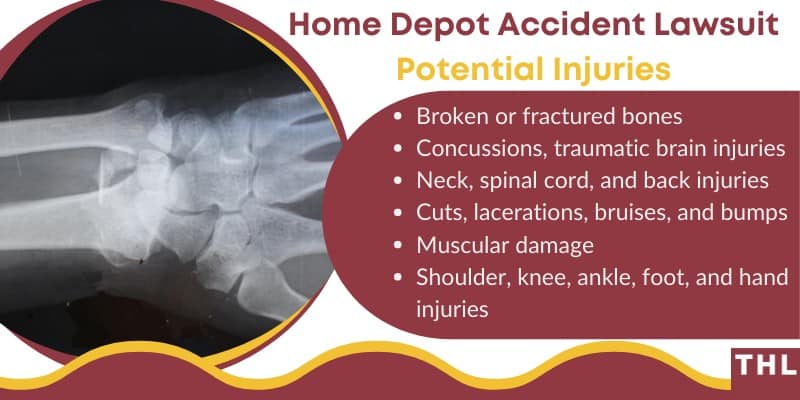 common injuries at home depot