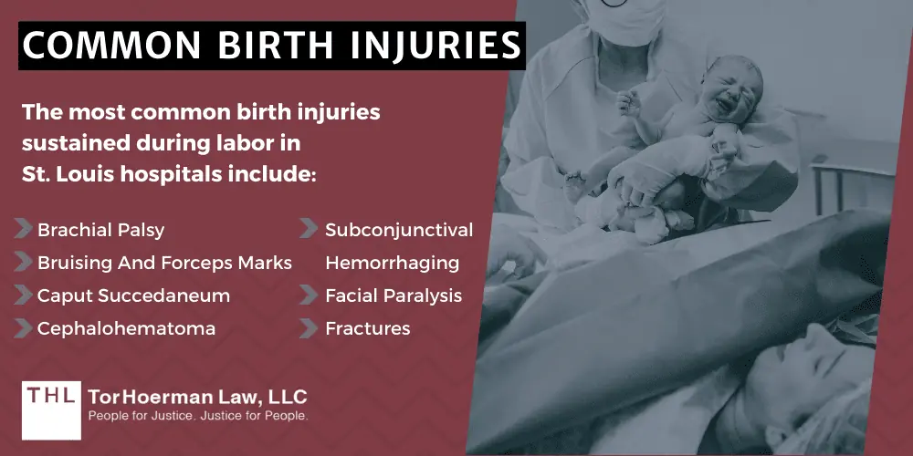 Common Birth Injuries