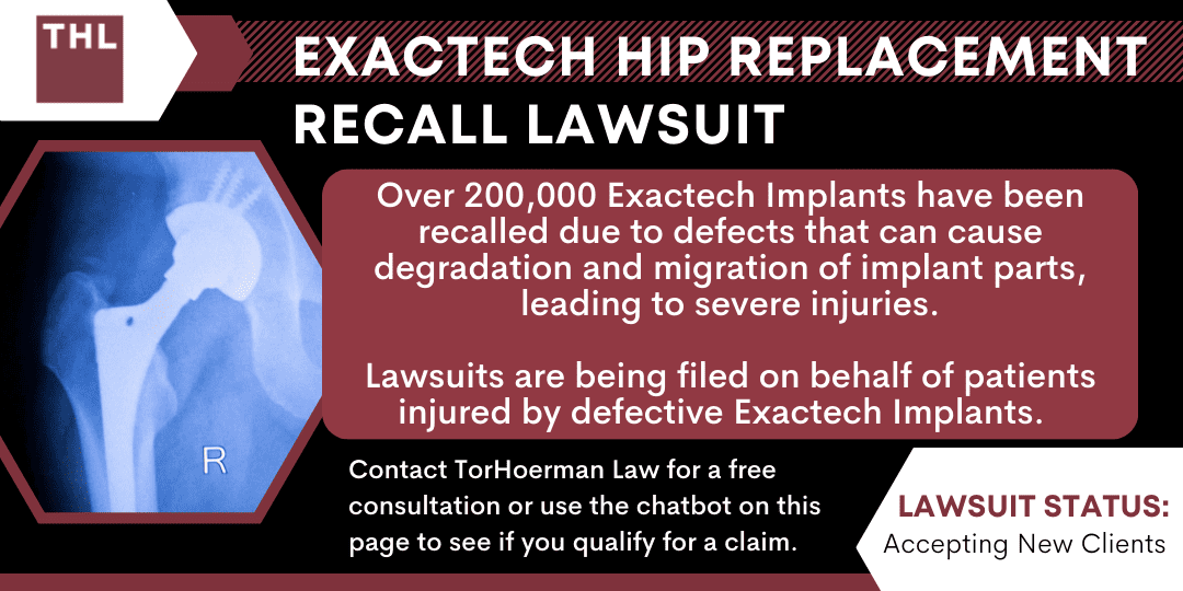 Exactech Hip Replacement Recall; Exactech Hip Replacement Recall Lawsuit; Exactech Hip Implant Lawsuit; Exactech Recall Lawsuit; Exactech Lawsuit; Exactech Lawsuits; Exactech Recall Lawsuits