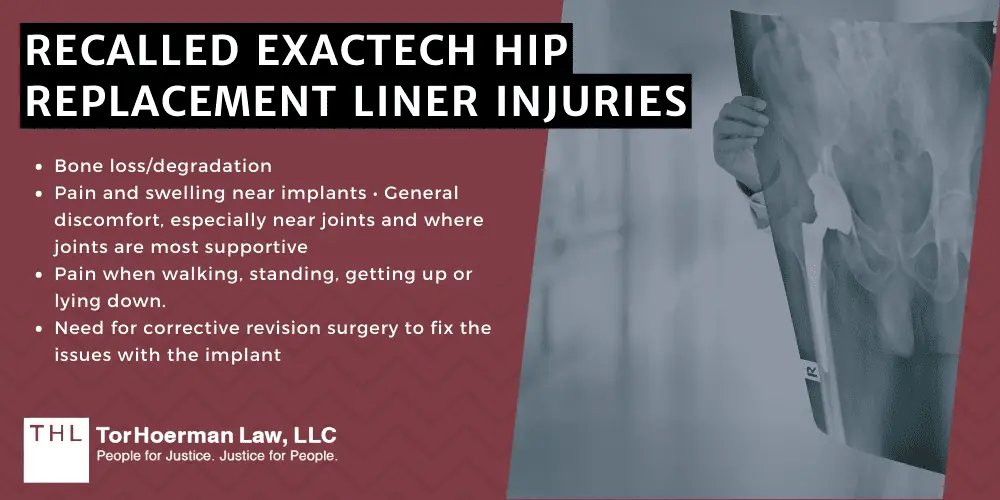 exactech hip replacement liner injuries