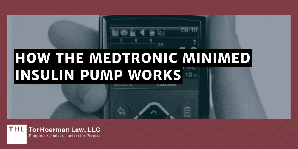How the Medtronic MiniMed Insulin Pump Works