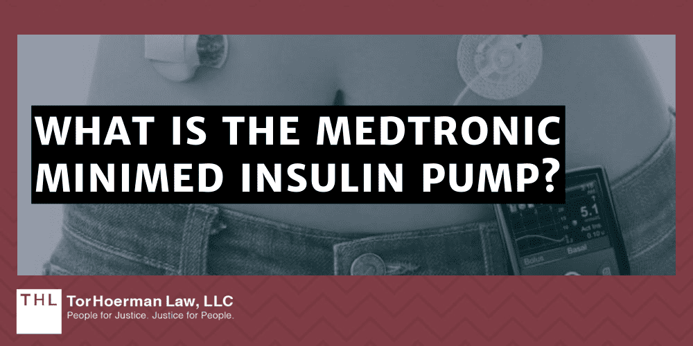 What is the Medtronic MiniMed Insulin Pump?
