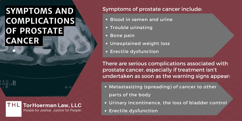 About Prostate Cancer; Symptoms and Complications of prostate cancer