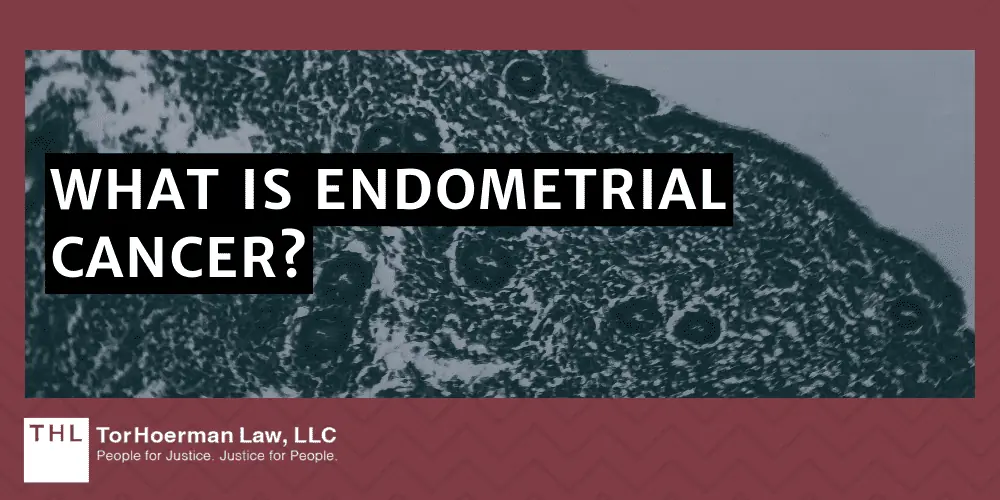 What is Endometrial Cancer?