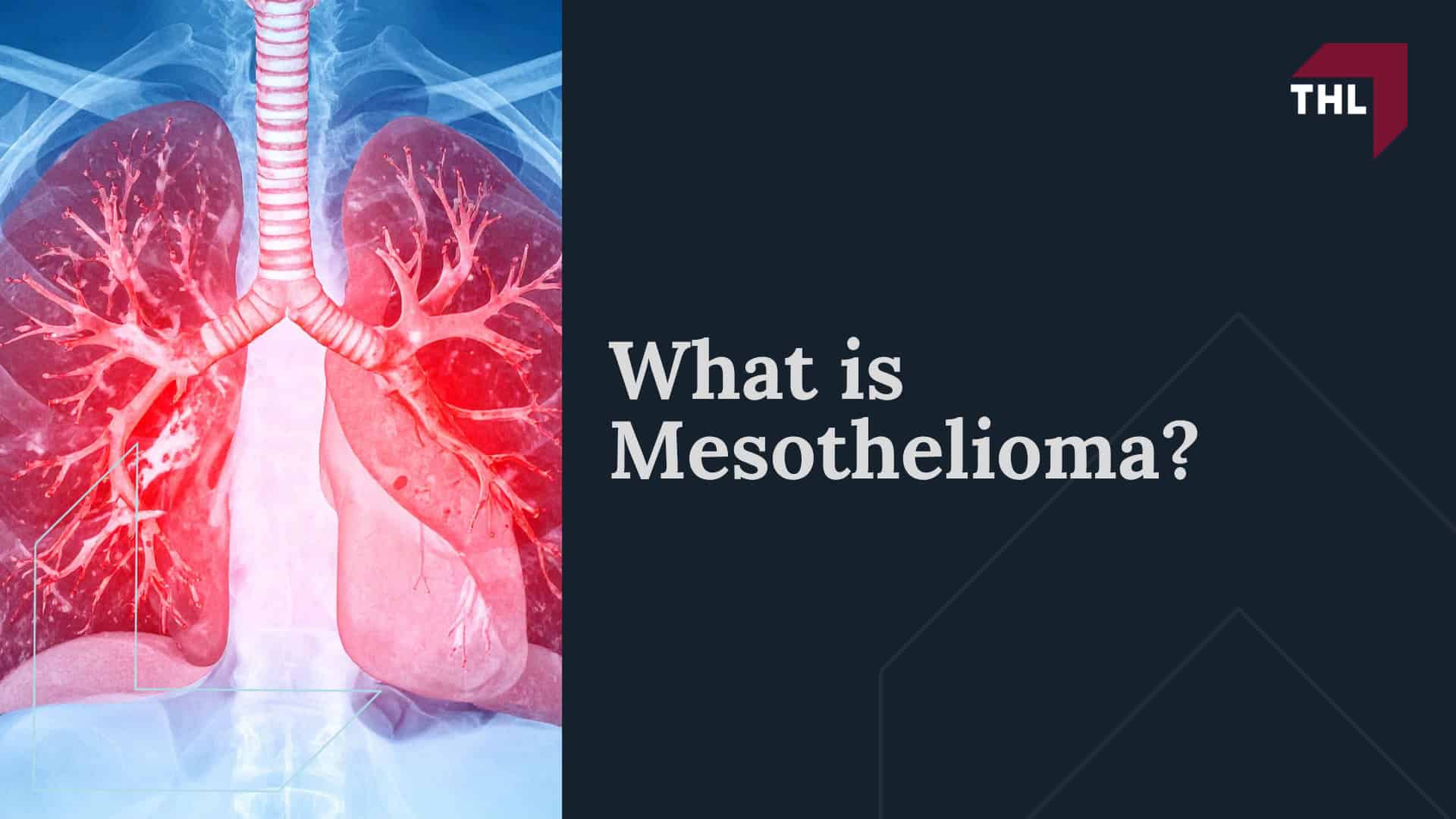 What is Mesothelioma