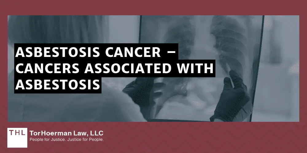 Asbestosis Cancer – Cancers Associated With Asbestosis