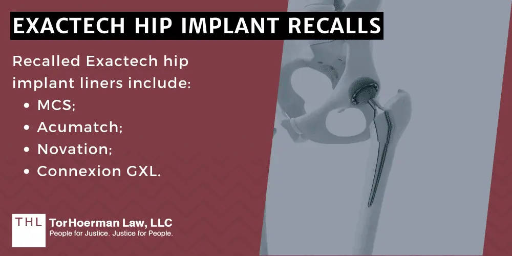 Exactech Hip Implant Recalls