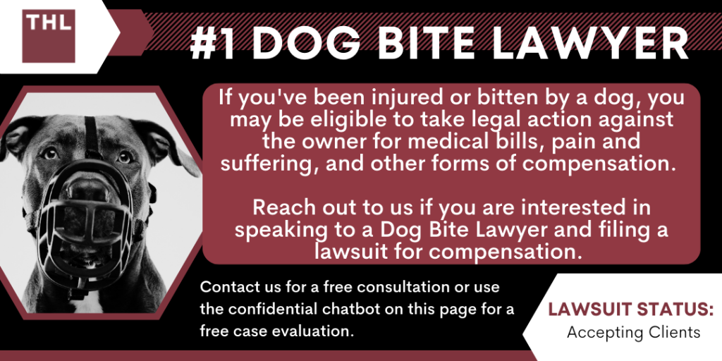 Dog Bite Lawyer; Dog Bite Injury Lawyer; Dog Bite Lawsuit; Dog Attack Lawyer; Pitbull Attack Lawyer; Pitbull Bite Lawyer; Dangerous Dog Lawyer