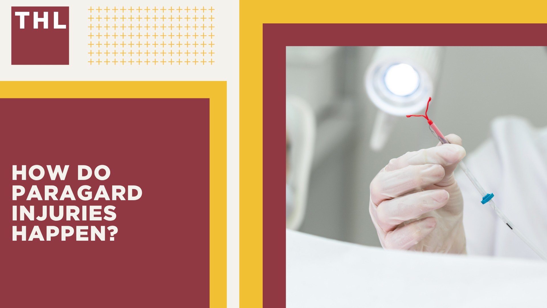Potential Paragard Settlement Amounts; What Types of Damages Can Be Claimed in the Paragard IUD Litigation; Paragard IUD Lawsuit Overview; How Do Paragard Injuries Happen