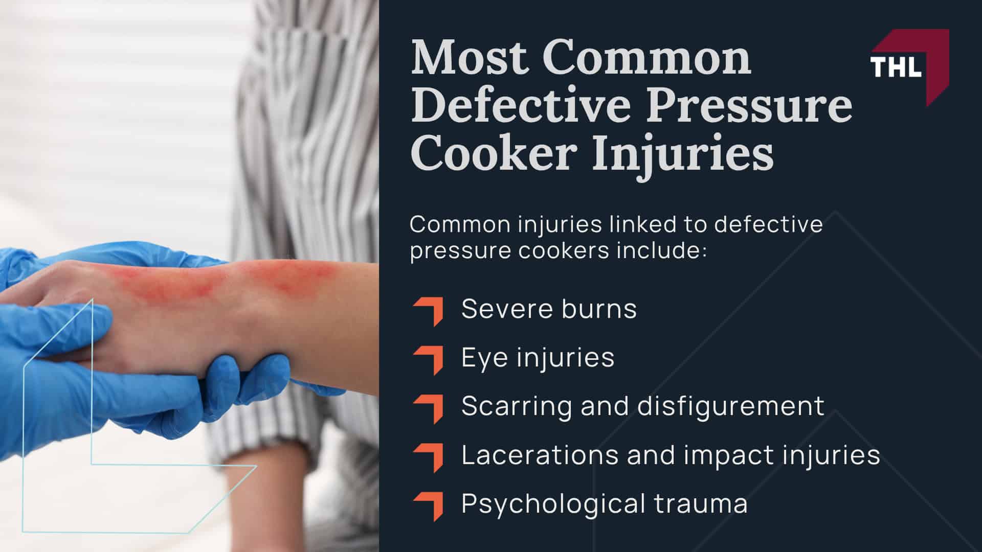 Everything You Need To Know About Pressure Cooker Explosions; Why Do Pressure Cookers Explode; Most Common Defective Pressure Cooker Injuries