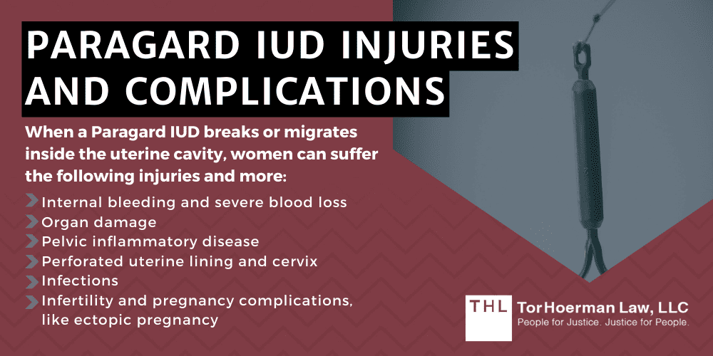 Paragard IUD Injuries and Complications