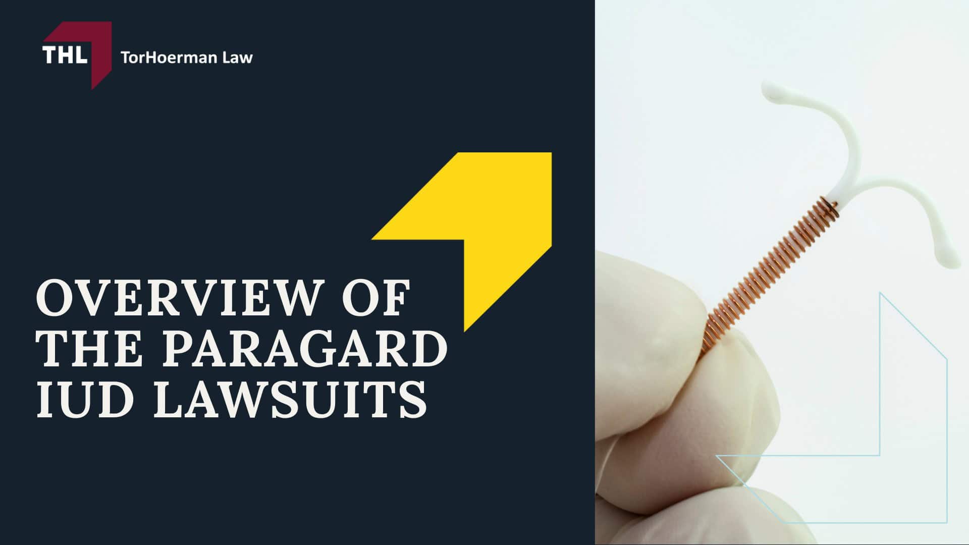 Paragard Lawyer - Overview of the Paragard IUD Lawsuits - torhoerman law