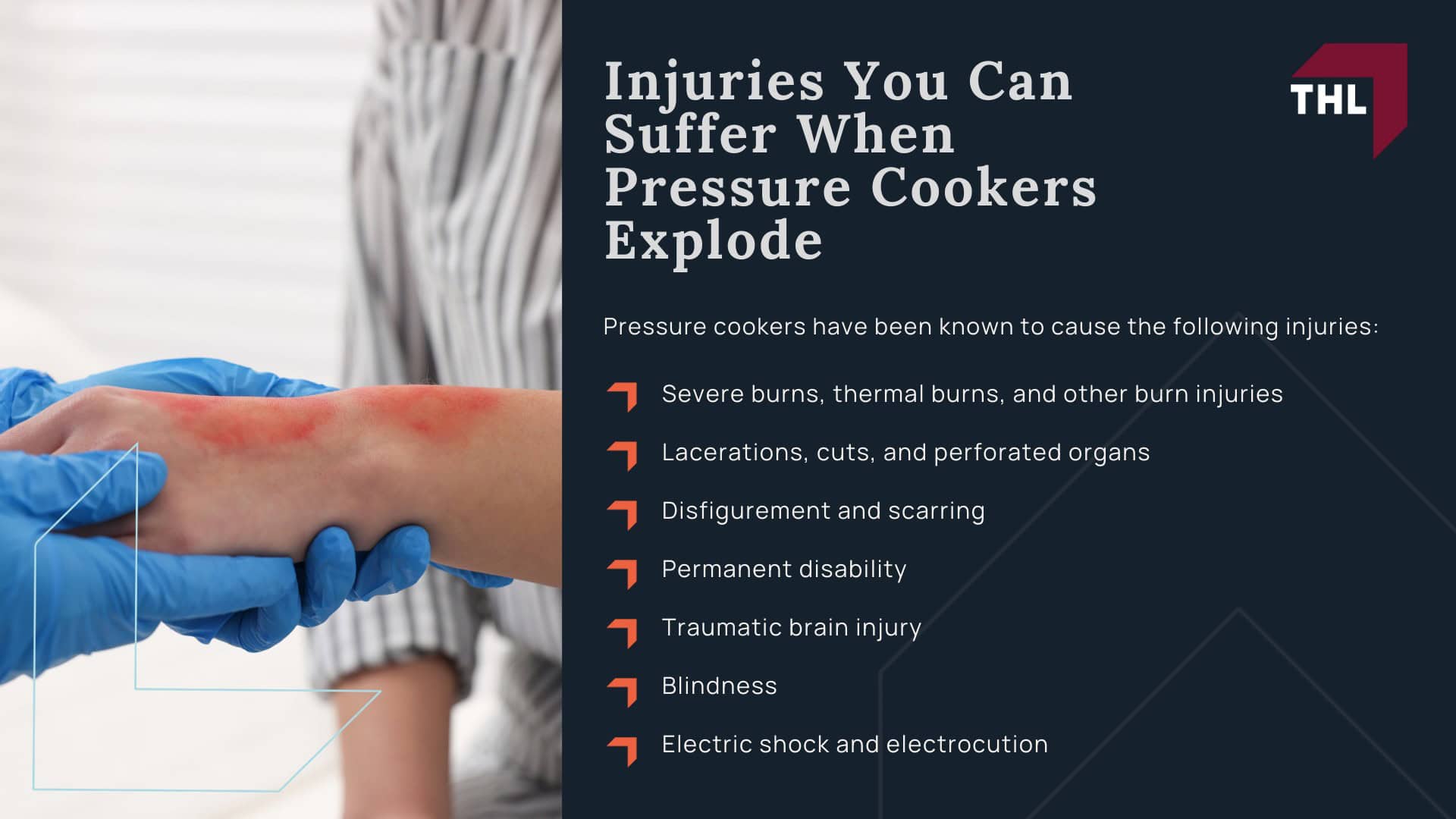 Pressure Cooker Accidents Can a Pressure Cooker Explode - Pressure Cookers How Do They Work - torhoerman law; Pressure Cooker Accidents Can a Pressure Cooker Explode - How and Why a Pressure Cooker Explosion Can Happen - torhoerman law; Pressure Cooker Accidents Can a Pressure Cooker Explode - Common Defects That Cause Pressure Cooker Explosions - torhoerman law; Pressure Cooker Accidents Can a Pressure Cooker Explode - Injuries You Can Suffer When Pressure Cookers Explode - torhoerman law