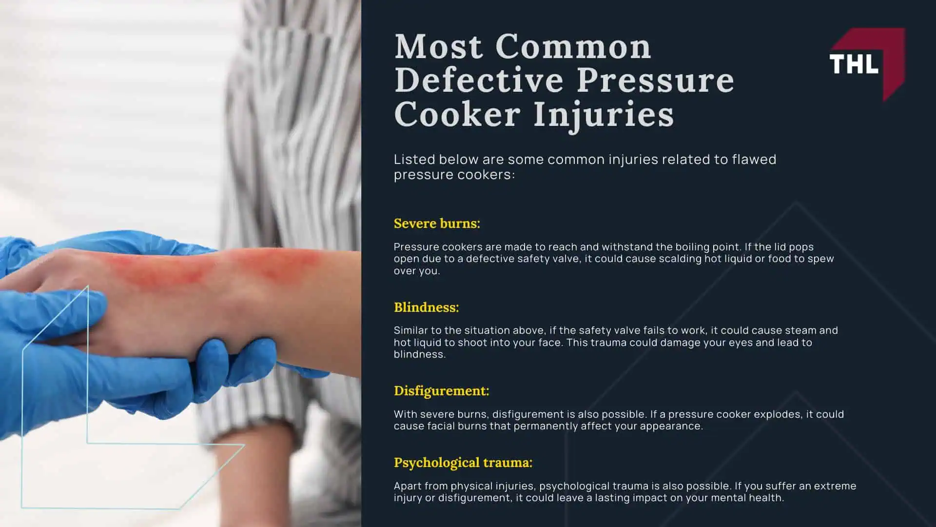 _Pressure Cooker Exploded The #1 Pressure Cooker Lawyers Can Help - Everything You Need To Know About Pressure Cooker Explosions; _Pressure Cooker Exploded The #1 Pressure Cooker Lawyers Can Help - Pressure Cooker Explosions in the News; _Pressure Cooker Exploded The #1 Pressure Cooker Lawyers Can Help - Why Do Pressure Cookers Explode; _Pressure Cooker Exploded The #1 Pressure Cooker Lawyers Can Help - Documented Recalls for Defective Pressure Cookers and Instant Pots; _Pressure Cooker Exploded The #1 Pressure Cooker Lawyers Can Help - Most Common Defective Pressure Cooker Injuries