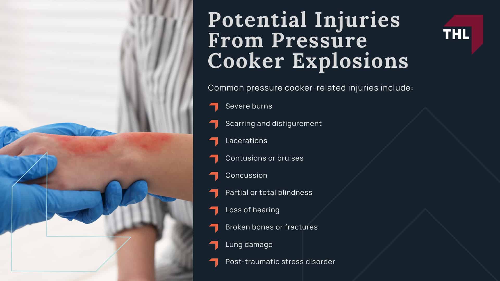 Pressure Cooker Settlement Amounts - What Is the Typical Settlement Range for a Pressure Cooker Lawsuit_ - torhoerman law; Pressure Cooker Settlement Amounts - Historic Pressure Cooker Lawsuits Settlements and Verdicts - torhoerman law; Pressure Cooker Settlement Amounts - Why and How Do Pressure Cookers Explode_ - torhoerman law; Pressure Cooker Settlement Amounts - Potential Injuries From Pressure Cooker Explosions - torhoerman law