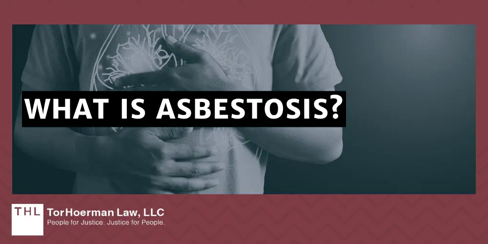 What is Asbestosis?