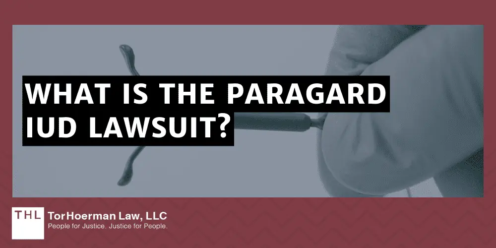 What Is the Paragard IUD Lawsuit?