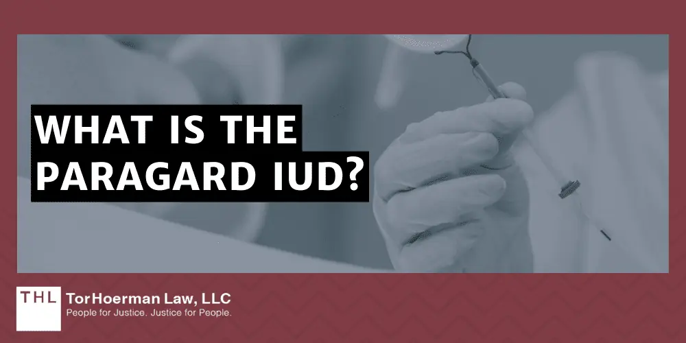 What is the Paragard IUD?