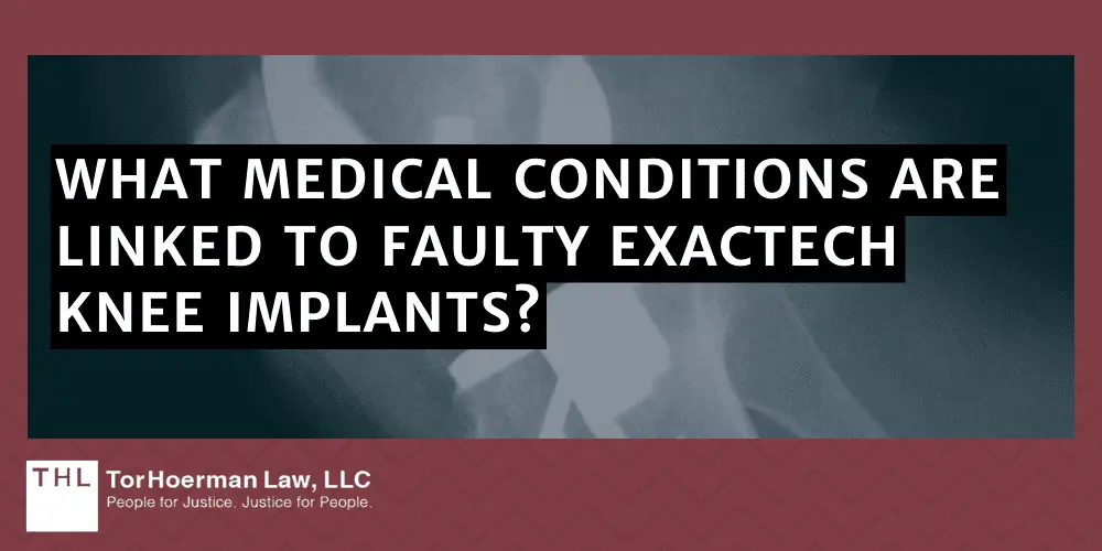 What Medical Conditions Are Linked To Faulty Exactech Knee Implants?