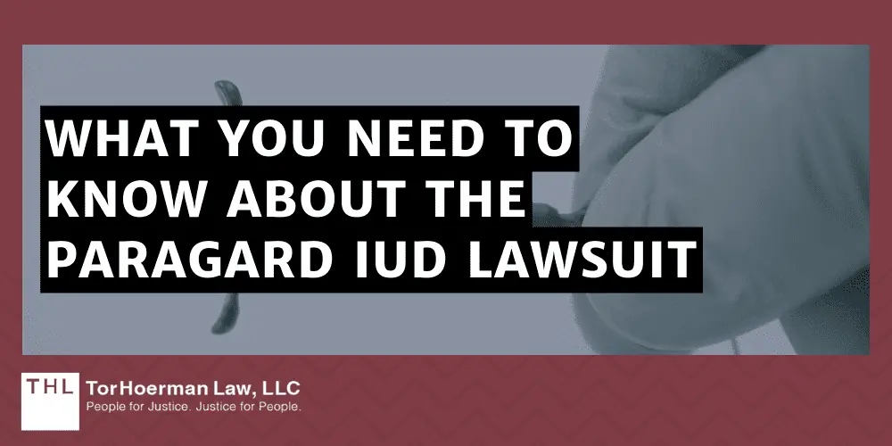 What You Need To Know About the Paragard IUD Lawsuit
