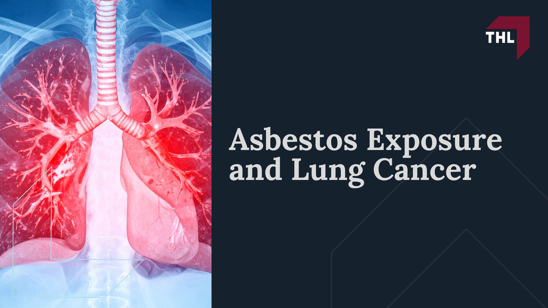 Asbestos Exposure and Lung Cancer