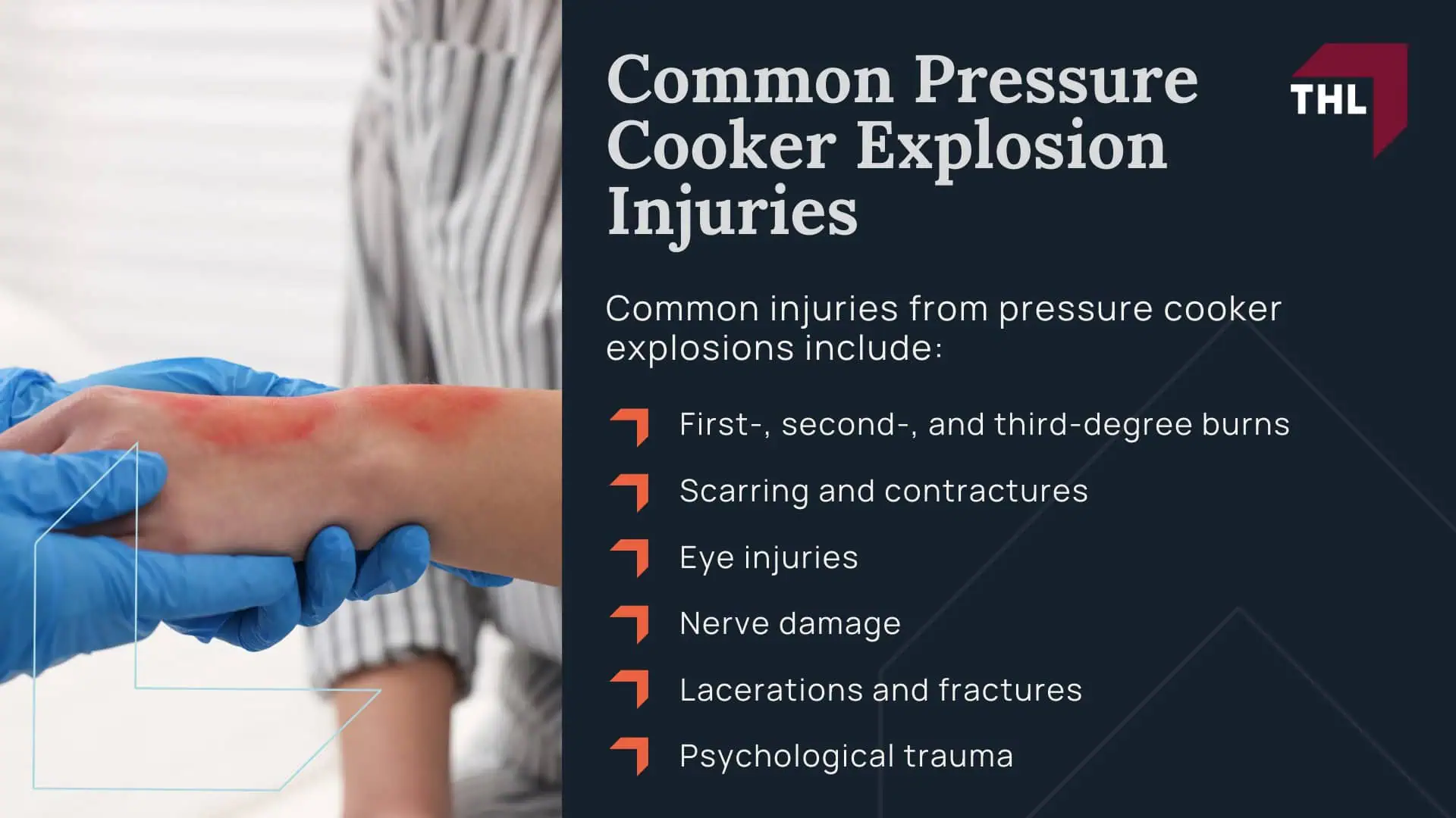 Pressure Cooker Explosion Lawsuit - Why Pressure Cookers Explode_ Common Defects and Safety Failures - torhoerman law; Pressure Cooker Explosion Lawsuit - How Pressure Cooker Safety Features Fail in Real-World Use - torhoerman law; Common Pressure Cooker Explosion Injuries - torhoerman law