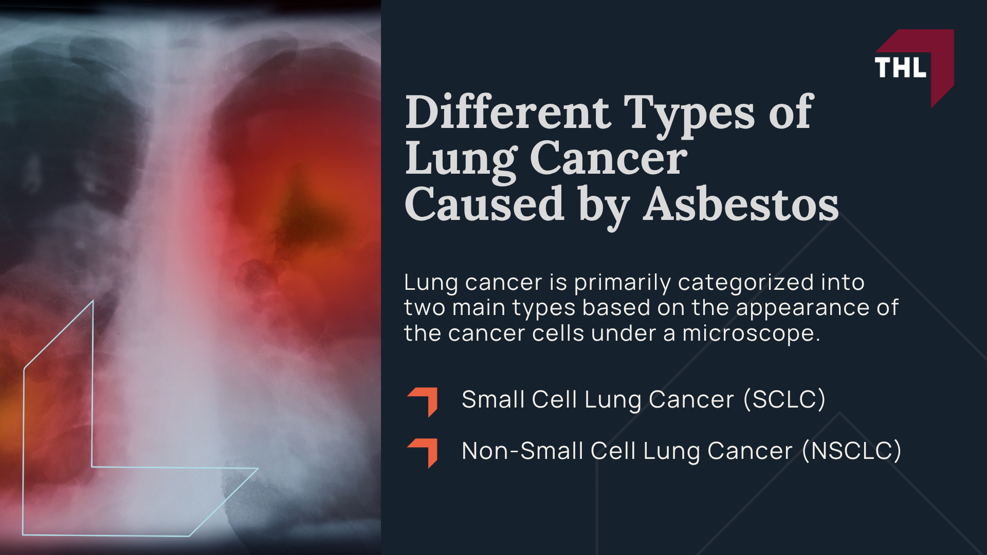 Asbestos Exposure and Lung Cancer; Different Types of Lung Cancer Caused by Asbestos