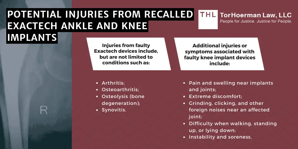 Potential Injuries From Recalled Exactech Ankle And Knee Implants