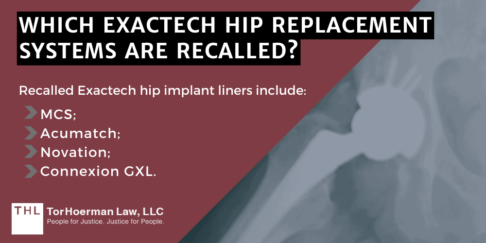 Which Exactech Hip Replacement Systems Are Recalled? 