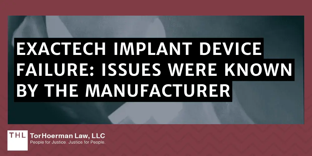 Exactech Implant Device Failure Issues Were Known By the Manufacturer