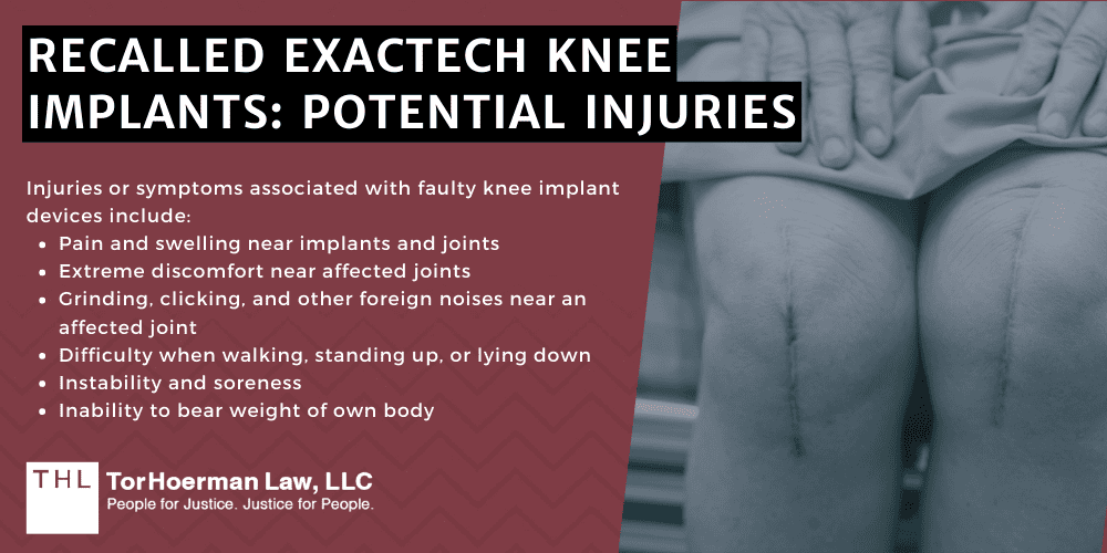 Recalled Exactech Knee Implants: Potential Injuries