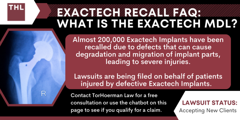 Exactech Recall FAQ What Is the Exactech MDL