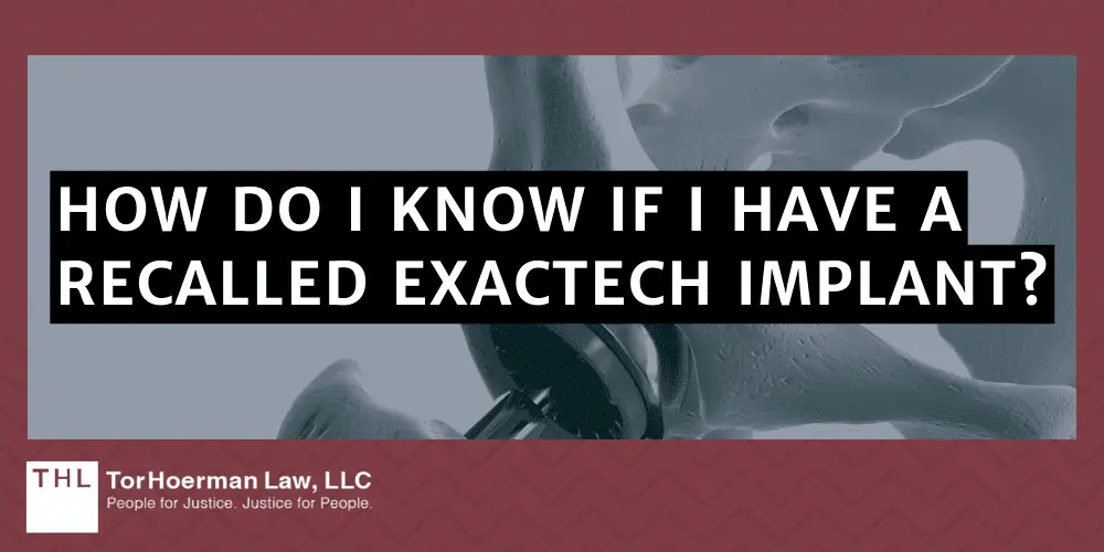 How Do I Know If I Have A Recalled Exactech Implant