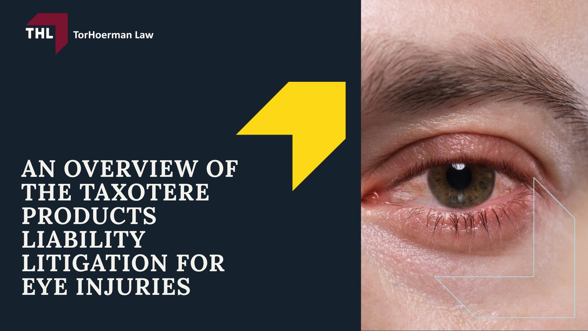 Taxotere Lawsuit Settlement Amounts - Average Taxotere Lawsuit Settlement Amount Projections - torhoerman law; Taxotere Lawsuit Settlement Amounts - Tier 1 Highest Severity – $150,000 to $400,000+ - torhoerman law; Taxotere Lawsuit Settlement Amounts - Tier 2 Moderate Severity – $75,000 to $150,000 - torhoerman law; Taxotere Lawsuit Settlement Amounts - Tier 3 Lower Severity – $20,000 to $75,000 - torhoerman law; Taxotere Lawsuit Settlement Amounts - Factors That Might Affect Your Taxotere Lawsuit Settlement Payout Amount - torhoerman law; Taxotere Lawsuit Settlement Amounts - An Overview of the Taxotere Products Liability Litigation for Eye Injuries - torhoerman law