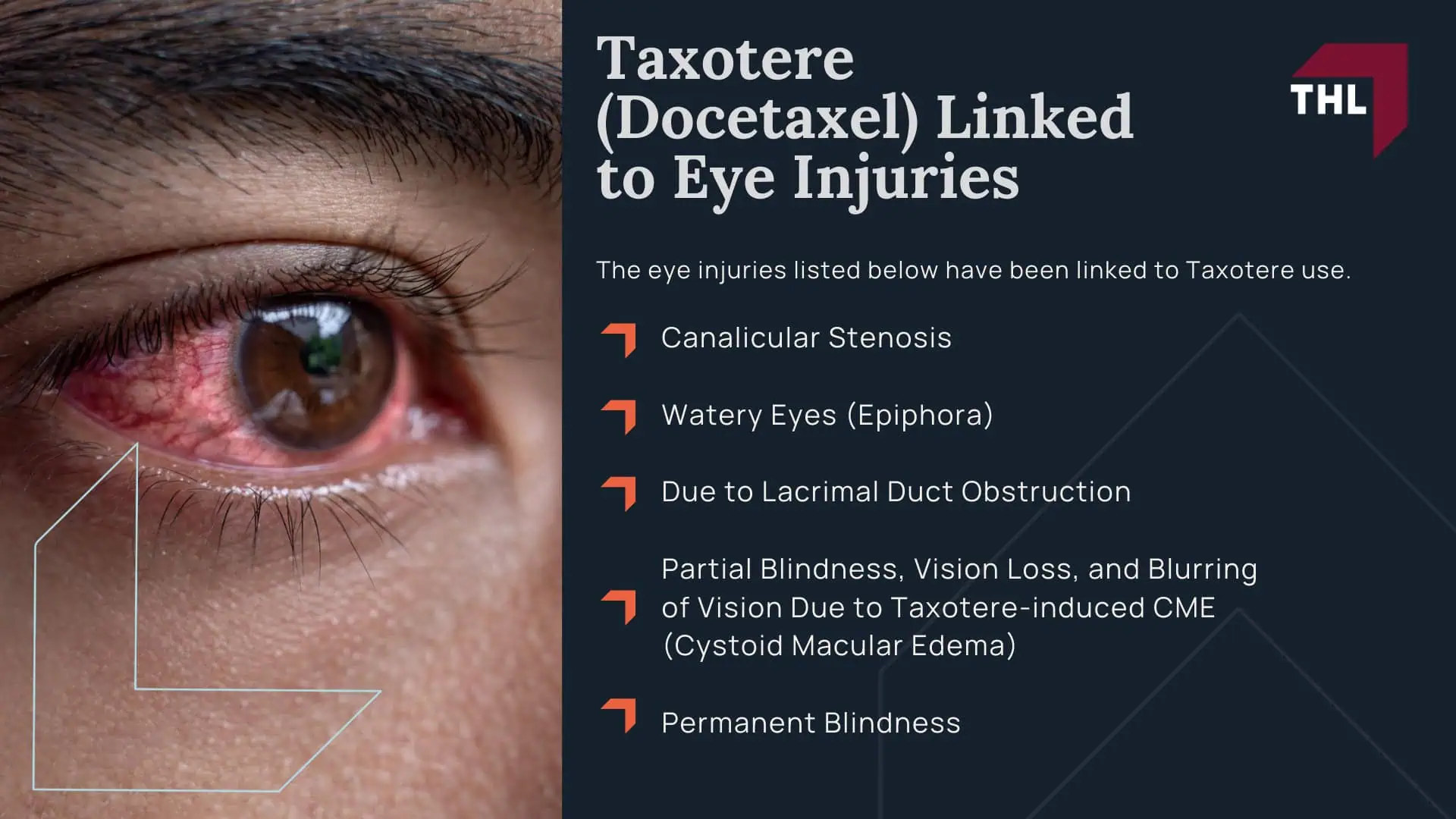 Taxotere Lawsuit Settlement Amounts - Average Taxotere Lawsuit Settlement Amount Projections - torhoerman law; Taxotere Lawsuit Settlement Amounts - Tier 1 Highest Severity – $150,000 to $400,000+ - torhoerman law; Taxotere Lawsuit Settlement Amounts - Tier 2 Moderate Severity – $75,000 to $150,000 - torhoerman law; Taxotere Lawsuit Settlement Amounts - Tier 3 Lower Severity – $20,000 to $75,000 - torhoerman law; Taxotere Lawsuit Settlement Amounts - Factors That Might Affect Your Taxotere Lawsuit Settlement Payout Amount - torhoerman law; Taxotere Lawsuit Settlement Amounts - An Overview of the Taxotere Products Liability Litigation for Eye Injuries - torhoerman law; Taxotere Lawsuit Settlement Amounts - Sanofi-Aventis Knew of the Risks Taxotere Posed to Breast Cancer Patients - torhoerman law; Taxotere Lawsuit Settlement Amounts - Taxotere (Docetaxel) Linked to Eye Injuries - torhoerman law