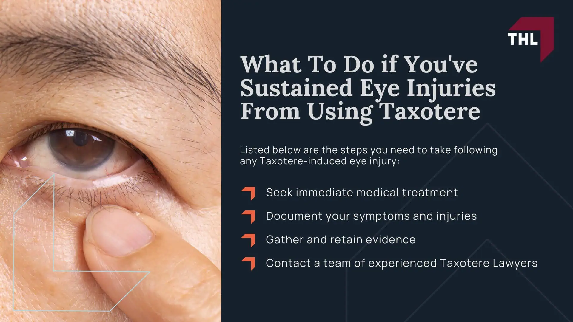 Taxotere Lawsuit Settlement Amounts - Average Taxotere Lawsuit Settlement Amount Projections - torhoerman law; Taxotere Lawsuit Settlement Amounts - Tier 1 Highest Severity – $150,000 to $400,000+ - torhoerman law; Taxotere Lawsuit Settlement Amounts - Tier 2 Moderate Severity – $75,000 to $150,000 - torhoerman law; Taxotere Lawsuit Settlement Amounts - Tier 3 Lower Severity – $20,000 to $75,000 - torhoerman law; Taxotere Lawsuit Settlement Amounts - Factors That Might Affect Your Taxotere Lawsuit Settlement Payout Amount - torhoerman law; Taxotere Lawsuit Settlement Amounts - An Overview of the Taxotere Products Liability Litigation for Eye Injuries - torhoerman law; Taxotere Lawsuit Settlement Amounts - Sanofi-Aventis Knew of the Risks Taxotere Posed to Breast Cancer Patients - torhoerman law; Taxotere Lawsuit Settlement Amounts - Taxotere (Docetaxel) Linked to Eye Injuries - torhoerman law; Taxotere Lawsuit Settlement Amounts - What To Do if You've Sustained Eye Injuries From Using Taxotere - torhoerman law
