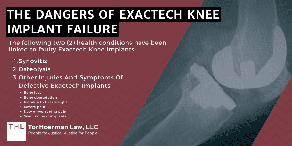 The Dangers Of Exactech Knee Implant Failure