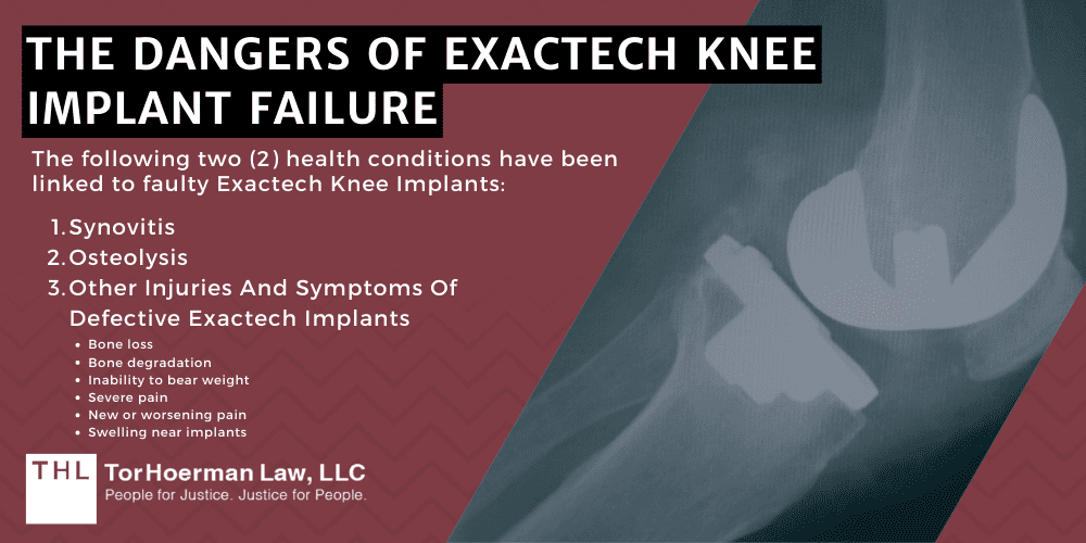 Exactech Knee Replacement Lawsuit; Exactech Knee Replacement Recall Lawsuit; Exactech Implant Recall Lawsuits; Exactech Recall; Exactech Knee Implant Lawsuit; Exactech Lawsuit; Exactech Lawsuits; Exactech Lawyers; Exactech MDL; What Is The Exactech Implant Recall; Exactech Knee Implant Recalls; Recalled Exactech Knee Implants: Potential Injuries; The Dangers Of Exactech Knee Implant Failure